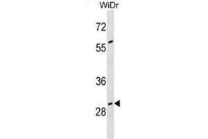 Western Blotting (WB) image for anti-Growth Arrest-Specific 2 (GAS2) antibody (ABIN3000565) (GAS2 抗体)