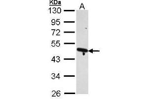 WB Image Sample (30 ug of whole cell lysate) A: H1299 10% SDS PAGE antibody diluted at 1:1000 (ACTR2 抗体)