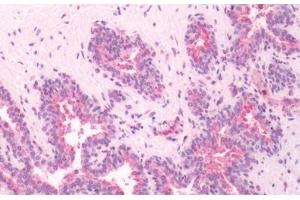 Immunohistochemistry (IHC) image for anti-G Protein-Coupled Receptor, Family C, Group 5, Member A (GPRC5A) (Cytoplasmic Domain) antibody (ABIN1048906)