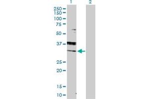 Western Blot analysis of RAB7A expression in transfected 293T cell line by RAB7A MaxPab polyclonal antibody. (RAB7A 抗体  (AA 1-207))