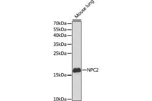Western blot analysis of extracts of mouse lung, using NPC2 antibody (ABIN6131887, ABIN6144762, ABIN6144763 and ABIN6221063) at 1:1000 dilution. (NPC2 抗体  (AA 20-151))