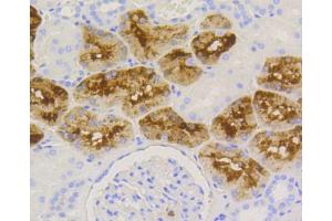 Immunohistochemistry of paraffin-embedded human kidney using LYZ antibody. (LYZ 抗体)