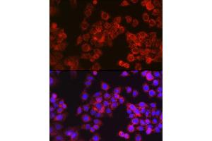 Immunofluorescence analysis of HeLa cells using CPT1A Rabbit pAb (ABIN6130129, ABIN6138976, ABIN6138977 and ABIN6220929) at dilution of 1:100 (40x lens). (CPT1A 抗体  (AA 497-756))