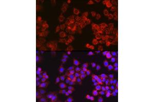 Immunofluorescence analysis of HeLa cells using CPT1A Rabbit pAb (ABIN6130129, ABIN6138976, ABIN6138977 and ABIN6220929) at dilution of 1:100 (40x lens).