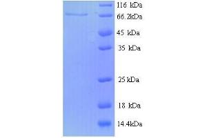 SDS-PAGE (SDS) image for Protein tyrosine Phosphatase, Receptor Type, N Polypeptide 2 (PTPRN2) (AA 28-600) protein (His tag) (ABIN5713772)