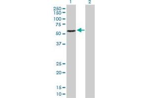 Western Blot analysis of RAD23B expression in transfected 293T cell line by RAD23B MaxPab polyclonal antibody. (RAD23B 抗体  (AA 1-409))