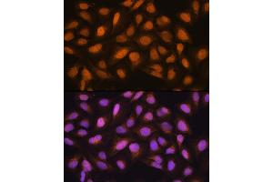 Immunofluorescence (IF) image for anti-S-Phase Kinase-Associated Protein 2 (SKP2) (AA 1-100) antibody (ABIN6147822)