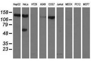 Image no. 2 for anti-L1 Cell Adhesion Molecule (L1CAM) antibody (ABIN1499090) (L1CAM 抗体)