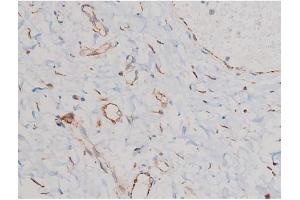 ABIN6267465 at 1/200 staining Human esophagus tissue sections by IHC-P. (CDC25A 抗体  (pSer124))