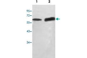 Western blot analysis of HepG2 cell (Lane 1) and human fetal testis (Lane 2) lysate with SCP2 polyclonal antibody  at 1 : 500 dilution. (SCP2 抗体  (AA 303-536))