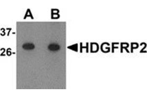 Western blot analysis of HDGFRP2 in human testis tissue lysate with HDGFRP2 antibody at (A) 0. (HDGFRP2 抗体  (N-Term))
