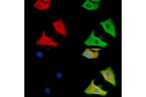 C12orf29 Antibody staining HepG2 cells by IF/ICC. (C12ORF29 抗体)