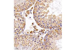 Immunohistochemistry (Paraffin-embedded Sections) (IHC (p)) image for anti-Signal Recognition Particle 14kDa (Homologous Alu RNA Binding Protein) (SRP14) antibody (ABIN7075596)