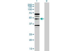 Western Blotting (WB) image for anti-Wingless-Type MMTV Integration Site Family, Member 5A (WNT5A) (AA 1-380) antibody (ABIN521384)