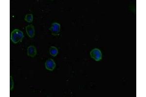 Immunofluorescent analysis of MCF-7 cells using ABIN7160242 at dilution of 1:100 and Alexa Fluor 488-congugated AffiniPure Goat Anti-Rabbit IgG(H+L) (SMAD5 抗体  (AA 1-209))