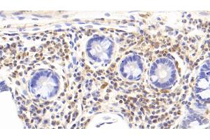 Detection of IL17 in Rabbit Colon Tissue using Monoclonal Antibody to Interleukin 17 (IL17) (IL-17 抗体  (AA 21-153))