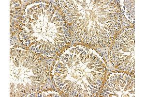 ABIN7096009 and ABIN7100071 at 1/100 staining rat testis tissue by IHC-P. (CCDC90B 抗体)
