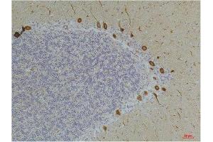 Immunohistochemistry (IHC) analysis of paraffin-embedded Human Brain Tissue using Ghrelin Receptor Rabbit Polyclonal Antibody diluted at 1:200. (GHSR 抗体)