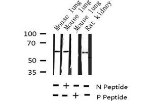 Western blot analysis of Phospho-G3BP-1 (Ser232) expression in various lysates (G3BP1 抗体  (pSer232))