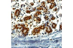ABIN184913 (2µg/ml) staining of paraffin embedded Human Breast. (KAP1 抗体  (C-Term))