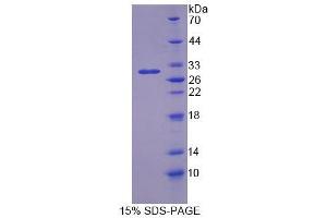 SDS-PAGE analysis of Rat OS9 Protein. (OS9 蛋白)
