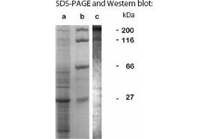 Western Blotting (WB) image for anti-LCCL Domain-Containing Protein CCP3 (LAP1) antibody (ABIN197620) (SRCR 抗体)