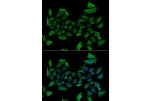 Immunofluorescence analysis of HeLa cells using ALAS1 antibody. (ALAS1 抗体)