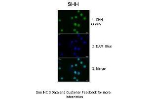 Immunohistochemistry (IHC) image for anti-Sonic Hedgehog (SHH) (N-Term) antibody (ABIN2781775)