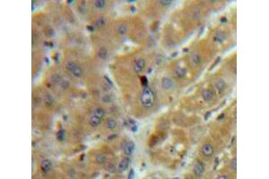 Used in DAB staining on fromalin fixed paraffin-embedded Liver tissue (TGFB1 抗体  (AA 279-390))