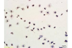 Gastric Cancer Cells labeled with Anti-Smac/DIABLO Polyclonal Antibody, Unconjugated (ABIN674619) followed by conjugation to the secondary antibody (DIABLO 抗体  (AA 131-239))