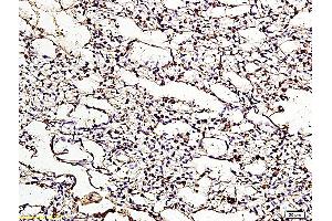Formalin-fixed and paraffin embedded chicken lung labeled with Anti ApoER2 Polyclonal Antibody, Unconjugated (ABIN719426) at 1:200 followed by conjugation to the secondary antibody and DAB staining (LRP8 抗体  (AA 851-963))