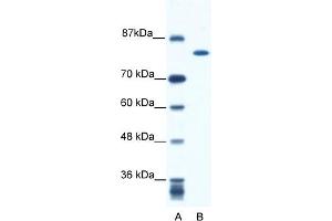 WB Suggested Anti-KIF23 Antibody Titration:  0. (KIF23 抗体  (N-Term))