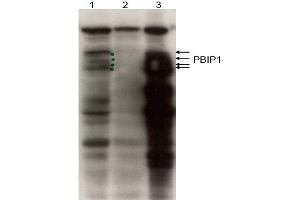 Image no. 1 for anti-MLF1 Interacting Protein (MLF1IP) (N-Term) antibody (ABIN401441) (MLF1IP 抗体  (N-Term))