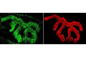 Immunohistochemistry analysis using Rabbit Anti-Piccolo Polyclonal Antibody (ABIN863197). (Piccolo 抗体)