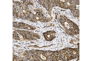 IHC analysis of Claudin 3/CLDN3 using anti-Claudin 3/CLDN3 antibody (ABIN7599626). (Claudin 3 抗体  (AA 101-220))