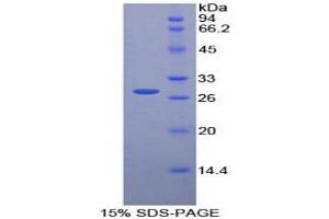 SDS-PAGE analysis of Rat Pyridoxal Kinase Protein. (PDXK 蛋白)