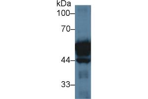 Western Blot; Sample: Rat Small intestine lysate; Primary Ab: 3µg/ml Rabbit Anti-Rat KRT20 Antibody Second Ab: 0.
