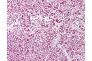 Immunohistochemistry (IHC) image for anti-Nuclear Factor of Activated T-Cells, Cytoplasmic, Calcineurin-Dependent 2 (NFAT1) (C-Term) antibody (ABIN6748576)