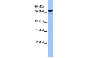 WB Suggested Anti-MTA2  Antibody Titration: 0. (MTA2 抗体  (Middle Region))