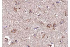 ABIN6267507 at 1/100 staining human brain tissue sections by IHC-P.