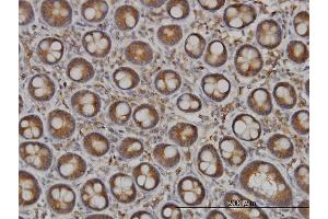 Immunoperoxidase of monoclonal antibody to NDST1 on formalin-fixed paraffin-embedded human small Intestine. (NDST1 抗体  (AA 38-136))