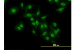 Immunofluorescence of monoclonal antibody to NFKB1 on HeLa cell. (NFKB1 抗体  (AA 860-969))