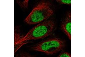 Immunofluorescent staining of human cell line U-2 OS with SFRS2IP polyclonal antibody  at 1-4 ug/mL dilution shows positivity in nucleus but not nucleoli. (SCAF11 抗体)