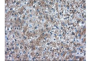 Immunohistochemical staining of paraffin-embedded Human prostate tissue using anti-RANGAP1 mouse monoclonal antibody. (RANGAP1 抗体)