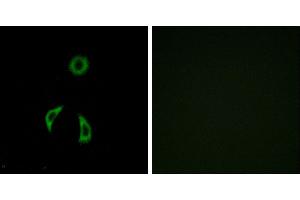 Peptide - +Western blot analysis of extracts from HUVEC cells, using FZD3 antibody. (FZD3 抗体  (Internal Region))