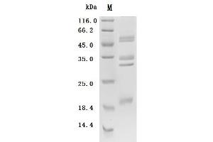 (Tris-Glycine gel) Discontinuous SDS-PAGE (reduced) with 5 % enrichment gel and 15 % separation gel.