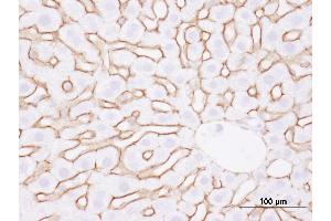 Immunohistochemistry (IHC) image for anti-Epidermal Growth Factor Receptor (EGFR) (C-Term) antibody (ABIN7448958)