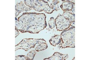 Immunohistochemistry of paraffin-embedded human placenta using Placental lactogen (CSH1) (CSH1) Rabbit mAb (ABIN7266353) at dilution of 1:100 (40x lens). (CSH1 抗体)