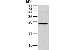 Gel: 12 % SDS-PAGE, Lysate: 40 μg, Lane: Human fetal intestines tissue, Primary antibody: ABIN7190229(CFC1 Antibody) at dilution 1/200 dilution, Secondary antibody: Goat anti rabbit IgG at 1/8000 dilution, Exposure time: 2 minutes (CFC1 抗体)