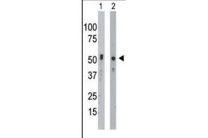 The anti-BCKDK Pab (ABIN391130 and ABIN2841253) is used in Western blot to detect BCKDK in mouse intestine tissue lysate (Lane 1) and Hela cell lysate (Lane 2). (BCKDK 抗体  (C-Term))